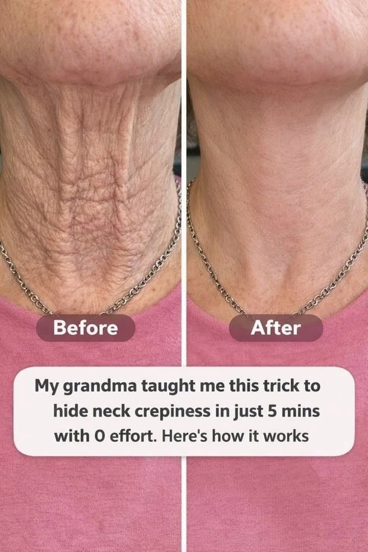 heal neck