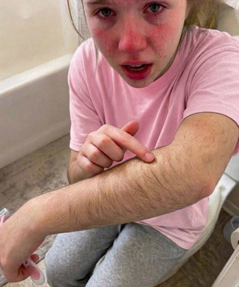 My Daughter’s First Boyfriend Mocked Her Arm Hair and Made Her Cry Her Father Had a Different Plan
