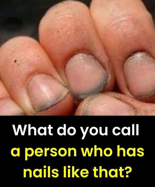 What do you call a person who has nails like that? What do you call a person who has nails like that?
